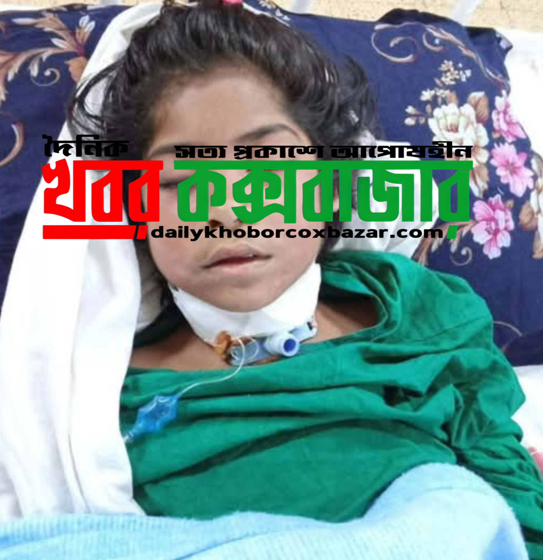 সীতাকুণ্ড ইকোপার্ক এলাকায় গুরুতর আহত শিশুর মৃত্যু