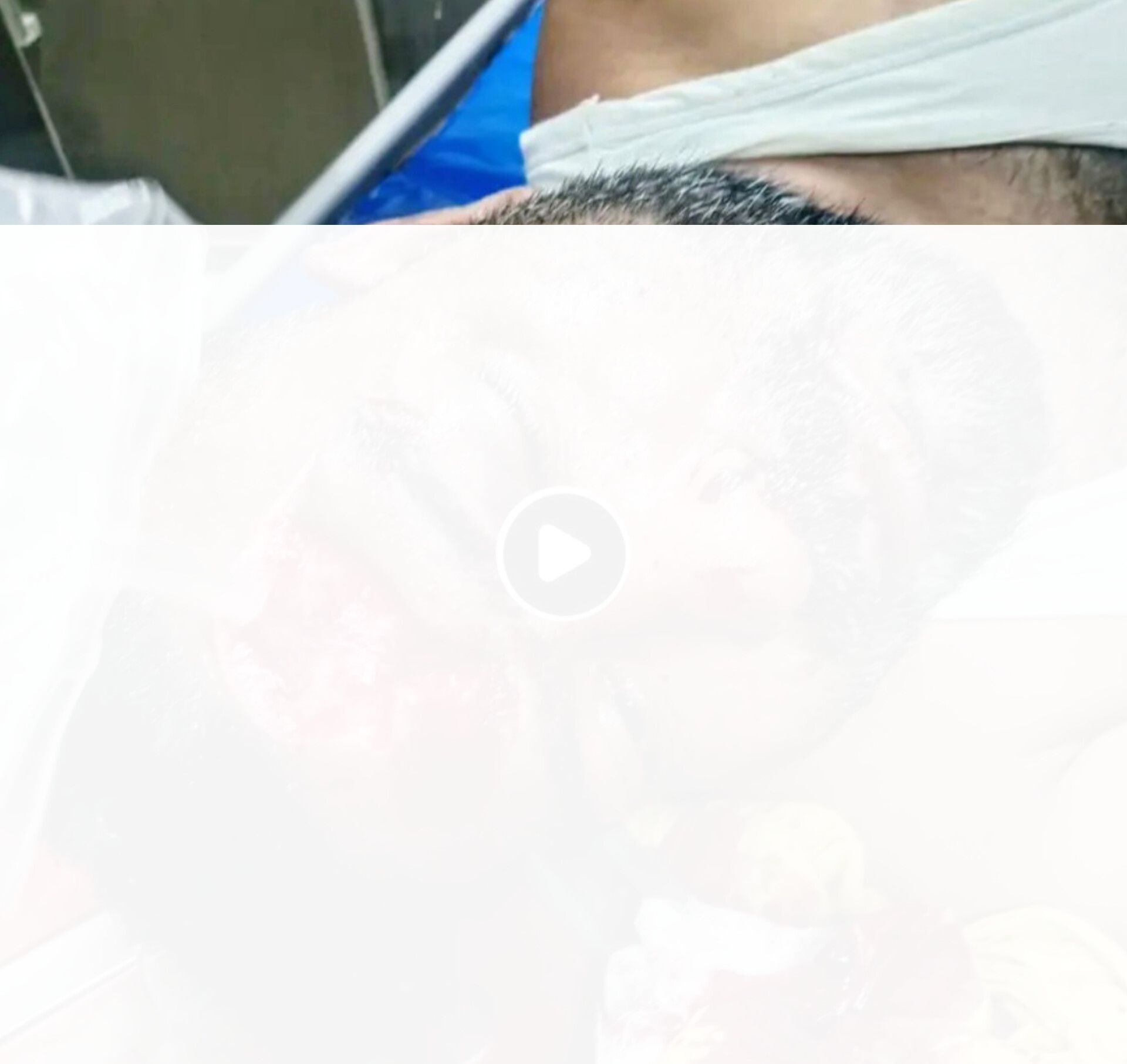 উখিয়ায় জায়গা-জমি নিয়ে বিরোধ: যুবককে কুপিয়ে গুরুতর জখম, চমেকে স্থানান্তর