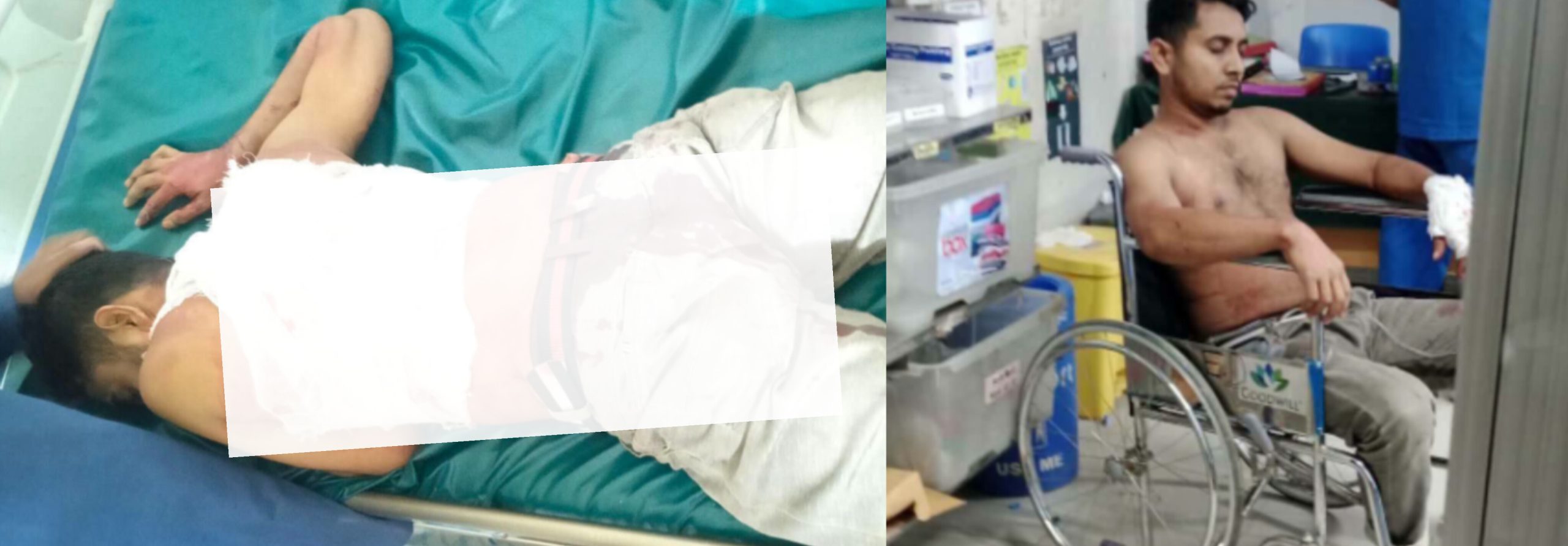 টেকনাফে দোকানদারকে কুপিয়ে গুরুতর আহত: আইনশৃঙ্খলার চরম অবনতি, এলাকাবাসী আতঙ্কিত