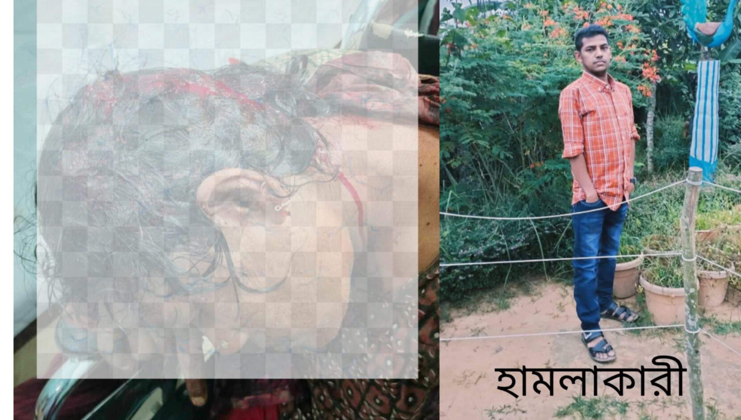 জমি জবরদখলে বাধা দেওয়ায় হামলার অভিযোগ, চট্টগ্রামে চিকিৎসাধীন ছকিনা বেগম
